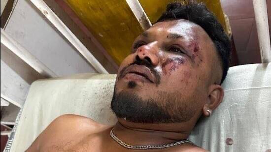 Air India crash survivor Vishwash Kumar Ramesh. Picture by X/ @Mukhtar